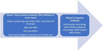 Stereo-Encephalographic Presurgical Evaluation of Temporal Lobe Epilepsy: An Evolving Science